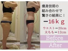 イーズスリミングプロ 横浜コレットマーレ店の雰囲気（４０代以降全身痩せに脂肪分解×筋肉増強waonder×強力リンパ◎）