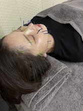 一期一縁 愛媛松山店/美容鍼50本コース