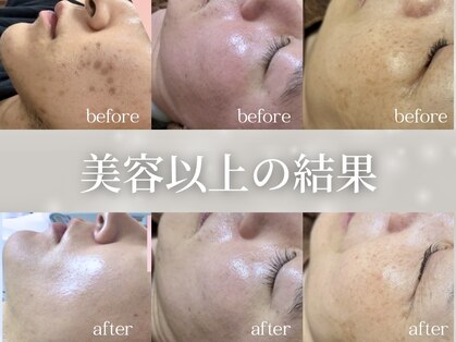 グランクウォーレ(Gran Cuore)の写真