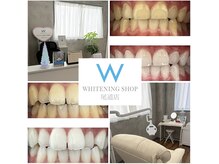 ホワイトニングショップ 尾道店(WHITENING SHOP)