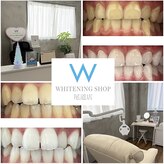 ホワイトニングショップ 尾道店(WHITENING SHOP)