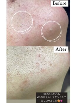 キレイノココロミ(きれいのCoCoRomi)/