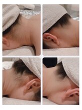 オーシャンスパ(Ocean Spa)/うなじ脱毛