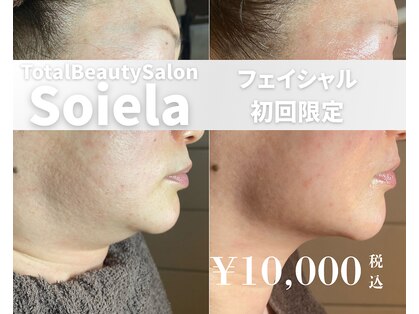 ソワラ(Soiela)の写真