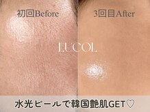 ルコル(LUCOL)の雰囲気（剥離なしのWiQo水光ピール★渡韓せず池袋西口で韓国肌管理◎）