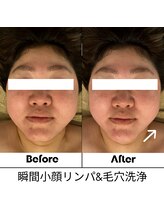 ルアナ 北谷店/小顔マッサージ &nbsp;《沖縄/北谷》