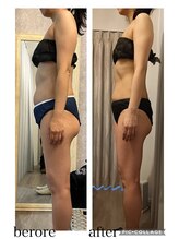 リープ(Lieb)/ボディビフォーアフター