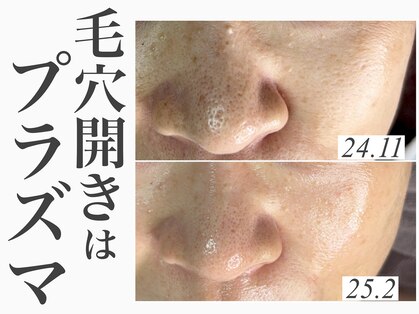 レイ(Rey)の写真