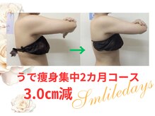 スマイルデイズ(Smiledays)/うで変身、今年はノースリーブ！