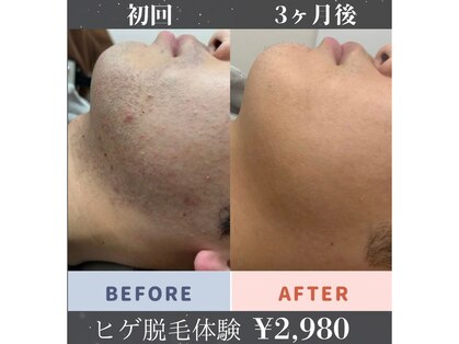 ジェントル(GENTLE)の写真