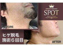 スポット 薬院駅前店(SPOT)の雰囲気（エステ&脱毛サロン口コミランキング天神1位/薬院1位を獲得♪感謝）