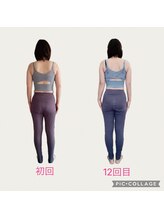 フォーシー(4C)/Before/After