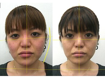 宮崎整体院/【美容整体】全身根本改善コース