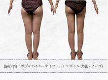 エメ 名古屋栄店(aimer)/レモンボトル<痩身・脂肪分解>