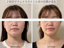 ミラ 長崎駅前店(MIRA)