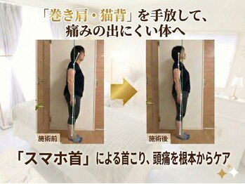 ミライズ 熊本健軍店/慢性の頭痛・首こりを根本改善