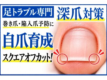 フットブルー 青山店の写真/【深爪・巻き爪・陥入爪対策】足トラブル専門技術・ドイツ式フットケア！プロによる足爪カットで自爪育成へ
