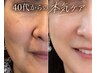 【40代からの本気ケア】もうファンデで隠さない。