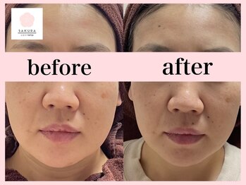 サクラ(SAKURA)/エアバリ効果