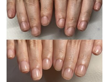 イズム(Izm)/上before/下after 約3ヶ月時点