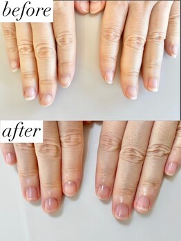ニコワイズネイル(Nico Y's Nail)/【自爪育成コース】