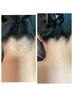 【お顔脱毛+うなじ脱毛+背上脱毛】16500→5500円
