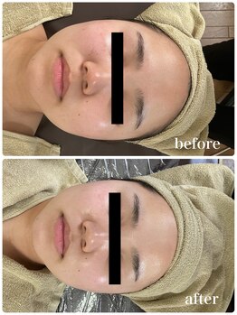 ジャスミン(Jasmin)/ブライダルケア