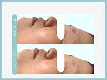 アコガレコガオ 仙台店/