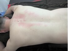 リデザイン 京都(REDESIGN)/REDESIGN京都中医施術法