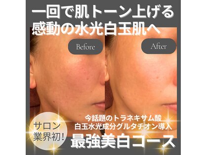 ラ ミュー エステハウス 松阪店の写真