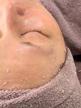 お肌をきれいにしたい