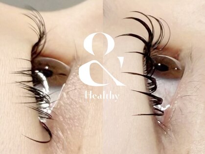 エピュレル(EPURELLE)の写真