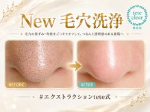 サロンド ケイティ(Salon de Katy)の雰囲気(今話題!の毛穴エクストラクション/毛穴洗浄/毛穴ケア/毛穴)