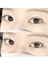 エメ 市川 本八幡(aimer)/パリジェンヌラッシュリフト