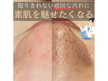 サロンドゥルシエル/【お肌診断付きカウンセリング】