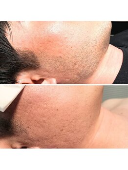 ティエル(TieLu)/