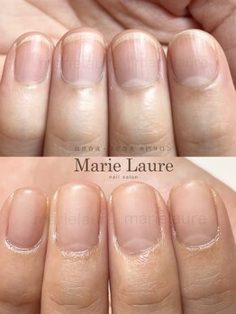 マリーロール 梅田店(Marie Laure)/深爪矯正/自爪育成/自爪風