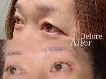 ハウオリ 高津 溝の口(Hauoli)/フラットラッシュ&アイブロウ