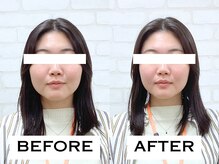 ビハリスト 麻布十番/むくみがとれて輪郭がすっきり！