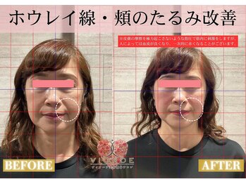 ヴィオーデ 新宿店/小顔、リンパ、ヘッドスパ、骨盤