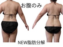 フロレゾン(Floraison)/あっという間にスッキリボディ