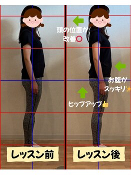 エヌアンドエヌ鍼灸院 福住店(N&えぬ鍼灸院)/ピラティス Before & After