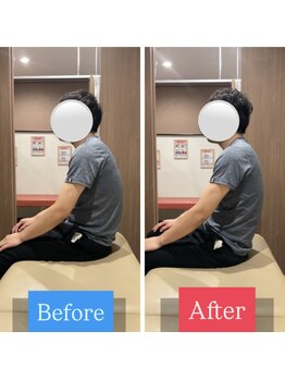 ナオル整体 宮崎院(NAORU整体)/30代男性施術事例【猫背改善】