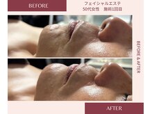 ウェルネス ステーション リンク(Wellness Station Link)/ビフォーアフター