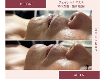 ウェルネス ステーション リンク(Wellness Station Link)/ビフォーアフター