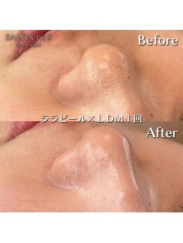 サロン ド エス アオヤマ(SALON DE S AOYAMA)/ララピール＆LDM（透明感UP）