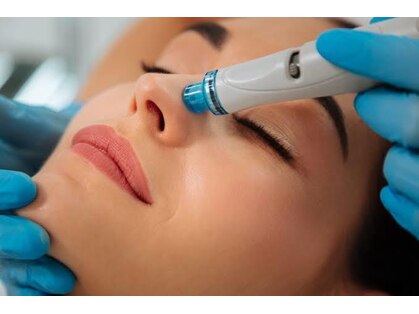 ノエル(NOeL)の写真