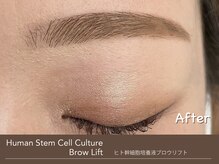アンモス 日本橋店(Ann Moss)/眉毛★ヒト幹細胞ブロウリフト◎