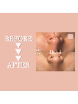 クリアラボ 日本橋(Clear Lab)/Before＆After