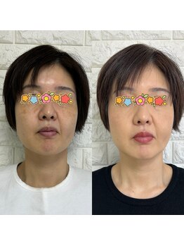 アマテラス(AMATERAS)/自己診断はもう卒業!